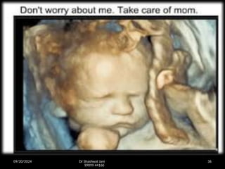 09/20/2024 Dr Shashwat Jani
99099 44160
36
 