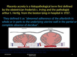 09/20/2024 Dr Shashwat Jani
99099 44160
4
Placenta accreta is a histopathological term first defined
by the obstetrician frederick c. Irving and the pathologist
arthur t. Hertig from the boston lying-in hospital in 1937.
They defined it as “abnormal adherence of the afterbirth in
whole or in parts to the underlying uterine wall in the partial or
complete absence of decidua”.
CLINICAL OBSTETRICS AND GYNECOLOGY VOLUME 00, NUMBER 00, 000–000
COPYRIGHT © 2018 WOLTERS KLUWER HEALTH, INC.
 
