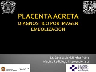 Dr. Saito Javier Méndez Rubio
Médico Radiólogo Intervencionista
 