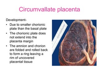 Chorionic Rim Placenta_and_Amniotic_fluid_Structure_Function.ppt