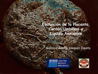 Evaluación de la Placenta,
Cordón Umbilical y
Líquido Amniótico
Gustavo Adolfo Vásquez Zapata
 