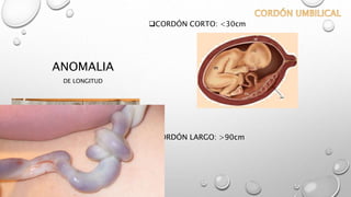 ANOMALIA
DE LONGITUD
CORDÓN CORTO: <30cm
CORDÓN LARGO: >90cm
 