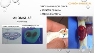 ANOMALIAS
VASCULARES
ARTERIA UMBILICAL ÚNICA:
AGENESIA PRIMARIA
ATRESIA O ATROFIA
 