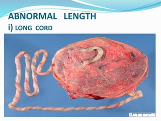 ABNORMAL LENGTH
i) LONG CORD
 