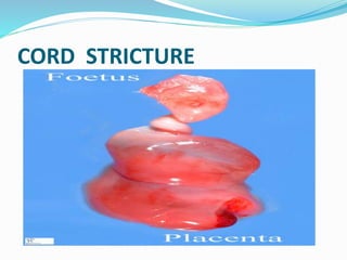 CORD STRICTURE
 