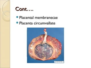 Cont….Cont….
Placental membranecae
Placenta circumvallate
 