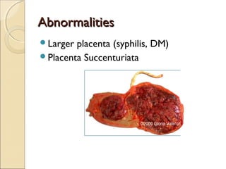 AbnormalitiesAbnormalities
Larger placenta (syphilis, DM)
Placenta Succenturiata
 