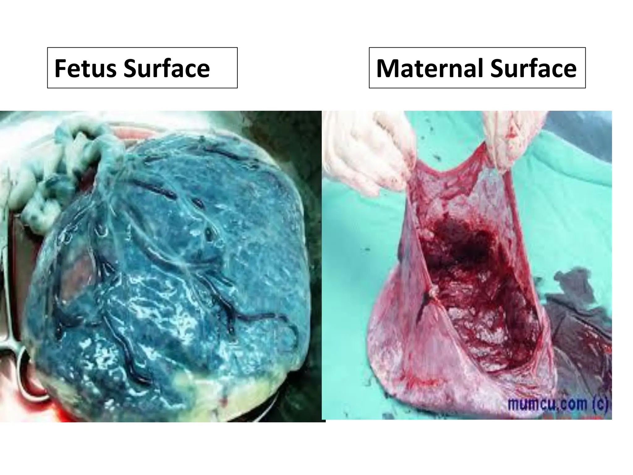 Maternal Surface
Fetus Surface
 
