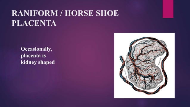 Placental and cord abnormalities | PPTX | Pregnancy | Reproductive Health