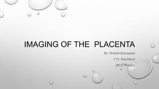 IMAGING OF THE PLACENTA
Dr. Vrishit Saraswat
I Yr. Resident
(M.D. Radio)
 