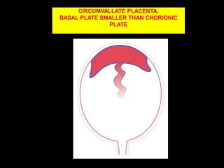 Normal placenta.NORMAL PLACENTA PLACENTAL SIZEExpressed  In terms  of thickness in the Midportion of organ                                                            ( 2 to 4cm).