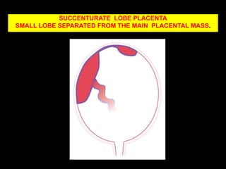 Thinning : systemic vascular / haematological disorder