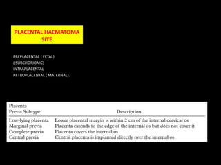 T SIGN IN A MONOCHORIONIC-DIAMNIOTIC TWIN GESTATION.©2009 by Radiological Society of North America