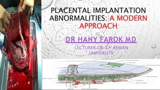 PLACENTAL IMPLANTATION
ABNORMALITIES: A MODERN
APPROACH
DR HANY FAROK MD
LECTURER OB-GY ASWAN
UNIVERSITY
 