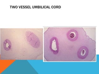 Placental pathology | PPTX