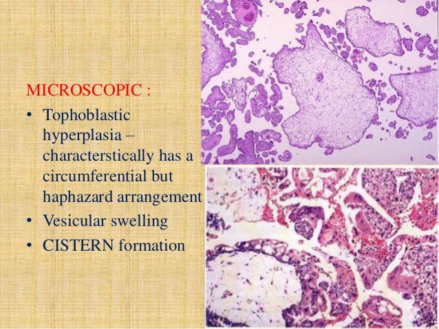 Placental pathology