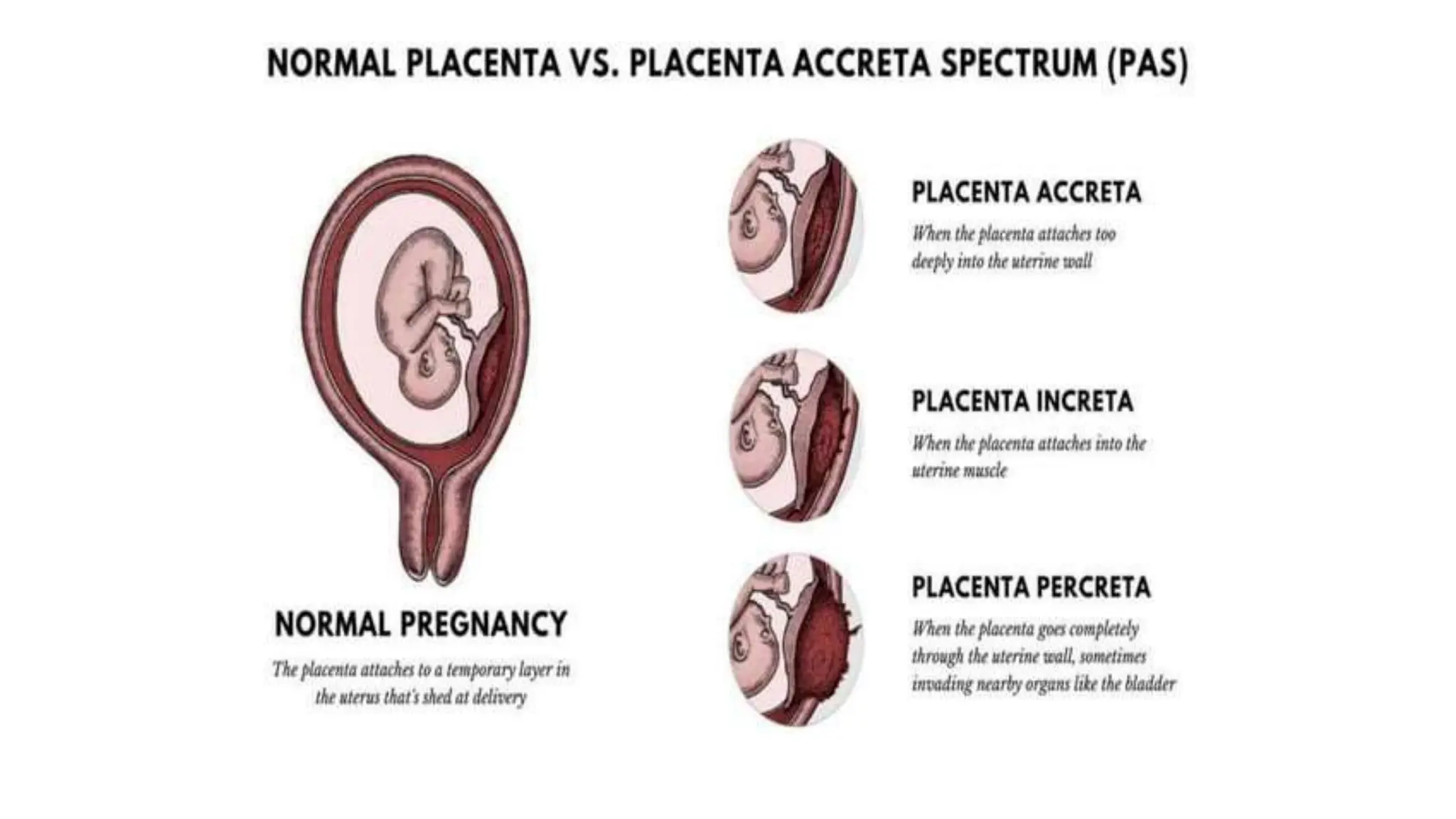 PLACENTA & MEMBRANES.pptx