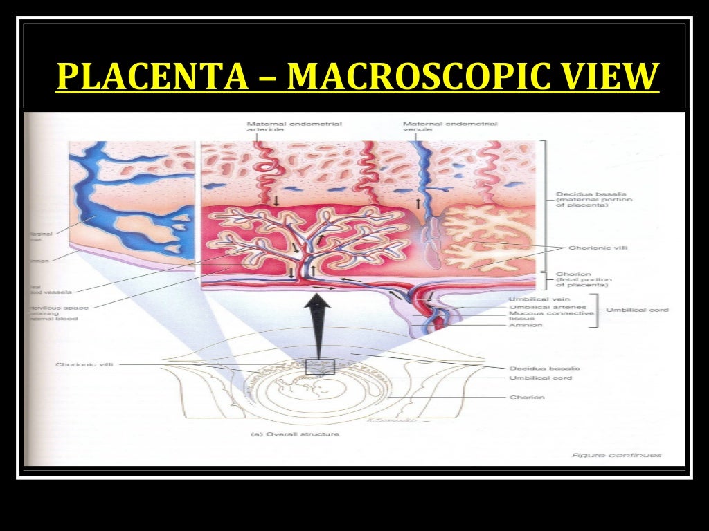 Placenta accreta image