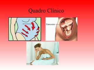 Quadro Clínico
 