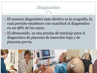 Diagnostico
 El examen diagnóstico más efectivo es la ecografía, la
cual permite establecer con exactitud el diagnóstico
en un 98% de los casos.
 El ultrasonido. es una prueba de tamizaje para el
diagnostico de placenta de inserción baja y de
placenta previa.
 