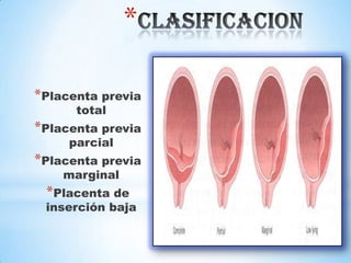 *
*Placenta previa
total
*Placenta previa
parcial
*Placenta previa
marginal
*Placenta de
inserción baja
 