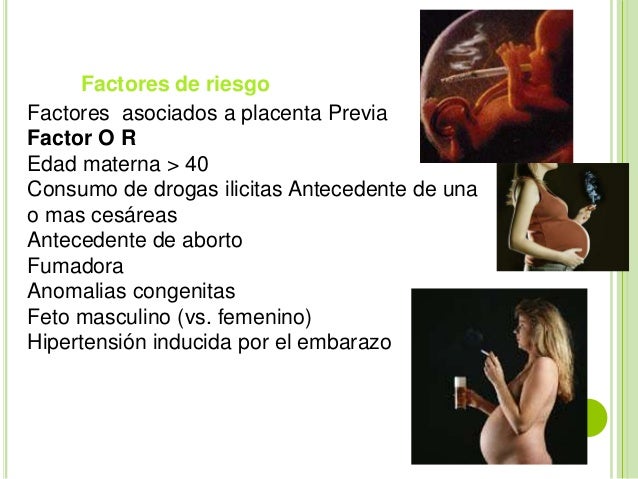Placenta previa Placenta previa
