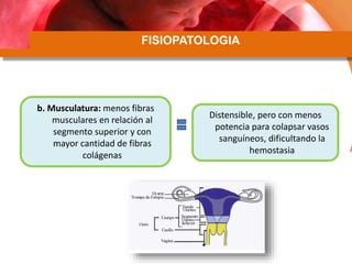 FISIOPATOLOGIA
b. Musculatura: menos fibras
musculares en relación al
segmento superior y con
mayor cantidad de fibras
colágenas
Distensible, pero con menos
potencia para colapsar vasos
sanguíneos, dificultando la
hemostasia
 