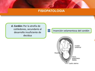 FISIOPATOLOGIA
d. Cordón: Por la atrofia de
cotiledones, secundario al
desarrollo insuficiente de
decidua
Inserción velamentosa del cordón
 