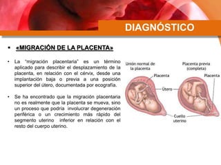 DIAGNÓSTICO
 «MIGRACIÓN DE LA PLACENTA»
• La “migración placentaria” es un término
aplicado para describir el desplazamiento de la
placenta, en relación con el cérvix, desde una
implantación baja o previa a una posición
superior del útero, documentada por ecografía.
• Se ha encontrado que la migración placentaria
no es realmente que la placenta se mueva, sino
un proceso que podría involucrar degeneración
periférica o un crecimiento más rápido del
segmento uterino inferior en relación con el
resto del cuerpo uterino.
 