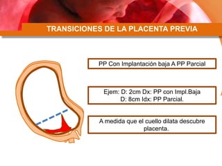 TRANSICIONES DE LA PLACENTA PREVIA
PP Con Implantación baja A PP Parcial
Ejem: D: 2cm Dx: PP con Impl.Baja
D: 8cm Idx: PP Parcial.
A medida que el cuello dilata descubre
placenta.
 