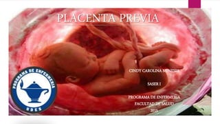 PLACENTA PREVIA
CINDY CAROLINA MENESES
SASER I
PROGRAMA DE ENFERMERIA
FACULTAD DE SALUD
2015
 