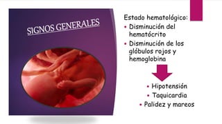 Estado hematológico:
 Disminución del
hematócrito
 Disminución de los
glóbulos rojos y
hemoglobina
 Hipotensión
 Taquicardia
 Palidez y mareos
 