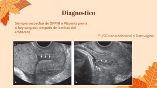 Diagnostico
Siempre sospechar de DPPNI o Placenta previa
si hay sangrado después de la mitad del
embarazo
**USG transabdominal o Transvaginal.
 