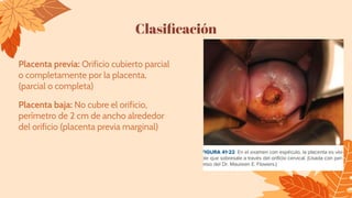 Clasiﬁcación
Placenta previa: Orificio cubierto parcial
o completamente por la placenta.
(parcial o completa)
Placenta baja: No cubre el orificio,
perímetro de 2 cm de ancho alrededor
del orificio (placenta previa marginal)
 