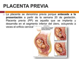 PLACENTA PREVIA
 La placenta se denomina previa porque antecede a la
presentación a partir de la semana 20 de gestación.
...