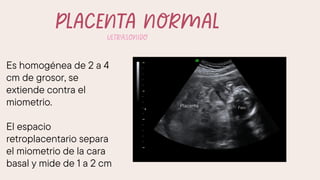 PLACENTA PREVIA Y DESPRENDIMIENTO PREMATURO DE PLACENTA.pdf
