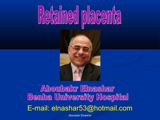 E-mail: elnashar53@hotmail.com
Aboubakr Elnashar
 