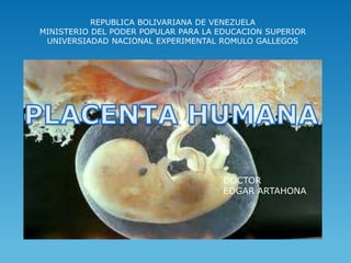REPUBLICA BOLIVARIANA DE VENEZUELA
MINISTERIO DEL PODER POPULAR PARA LA EDUCACION SUPERIOR
 UNIVERSIADAD NACIONAL EXPERIMENTAL ROMULO GALLEGOS




                                     DOCTOR
                                     EDGAR ARTAHONA
 