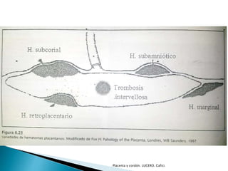 Placenta y cordón. LUCERO. Cafici. 
 