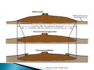 Placenta y cordón. LUCERO. Cafici. 
 