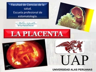 Facultad de Ciencias de la
          salud.
 Escuela profesional de
     estomatología.




                                 UAP
                             UNIVERSIDAD ALAS PERUANAS
 