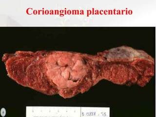 FUNCIONES DE LA PLACENTA

Hacia el final del 4to
mes de gestación, la
placenta produce:
- PROGESTERONA.
- HORMONAS
ESTROGÉ...