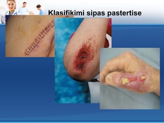 Klasifikimi sipas pastertise
 