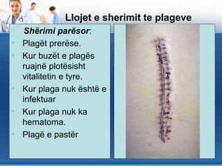 Llojet e sherimit te plageve
    Shërimi parësor:
•   Plagët prerëse.
•   Kur buzët e plagës
    ruajnë plotësisht
    vitalitetin e tyre.
•   Kur plaga nuk është e
    infektuar
•   Kur plaga nuk ka
    hematoma.
•   Plagë e pastër
 