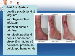 Shërimi dytësor:
•   buzët e plagës janë të
    larguara
•   kur plaga është e
    infektuar
•   kur zona është e
    dëmtuar
•   kur plagët pasi janë
    qepur rihapen për
    shkak të shfaqjes së
    nekrozës, pranisë së
    qelbit apo hematomës.
 