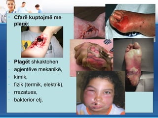 Plagët
• Cfarë kuptojmë me
  plagë:




•   Plagët shkaktohen
-   agjentëve mekanikë,
-   kimik,
-   fizik (termik, elektrik),
-   rrezatues,
-   bakterior etj.
 