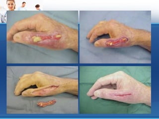 Plaget kujdesi ndaj tyre