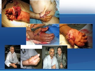 Plaget kujdesi ndaj tyre