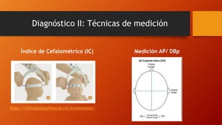 Diagnóstico II: Técnicas de medición
Índice de Cefalométrico (IC) Medición AP/ DBp
https://mimosbabypillow.se/nl/kraniometer/
 