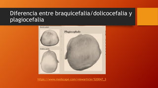 Diferencia entre braquicefalia/dolicocefalia y
plagiocefalia
https://www.medscape.com/viewarticle/520047_3
 